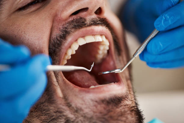 Best Walk-In Emergency Dentist in Belmont Estates, VA